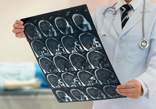 Neurologia
