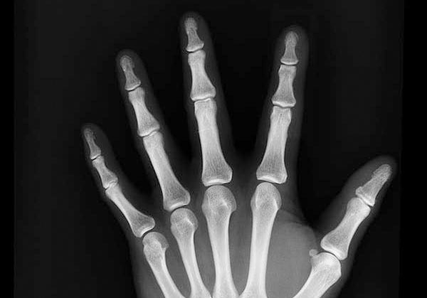radiografia ecografia
